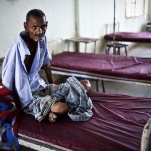 Cameroun/Sant? Publique: Prise en charge des tuberculeux